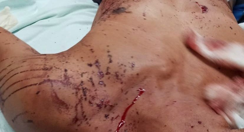 Briga familiar resulta em homem esfaqueado em Nova Andradina