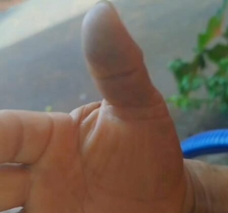 Acidente entre motocicleta e idoso no bairro Vitória, em Ivinhema