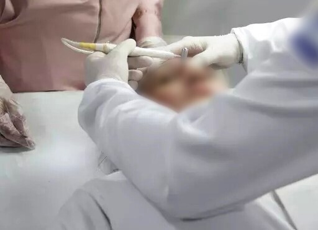 Uso do fenol é liberado pelo CFM, apesar de proibição da Anvisa